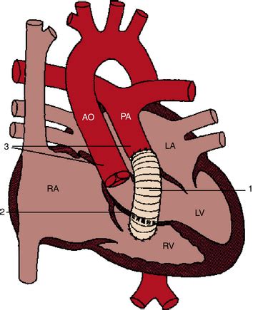 rv to pa conduit